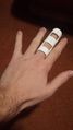3D Printed Finger Splint